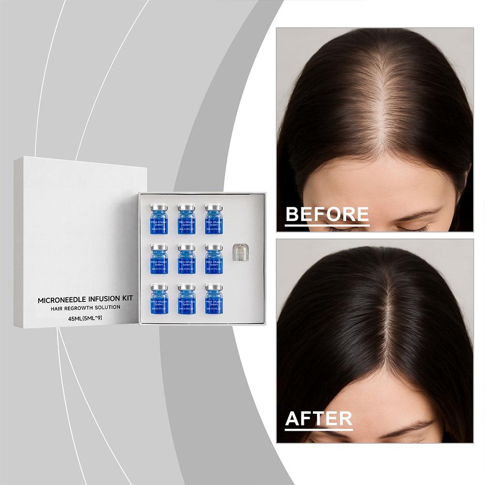 Derma Roller 0.25 - Набор для ухода за волосами: микроигольчатый