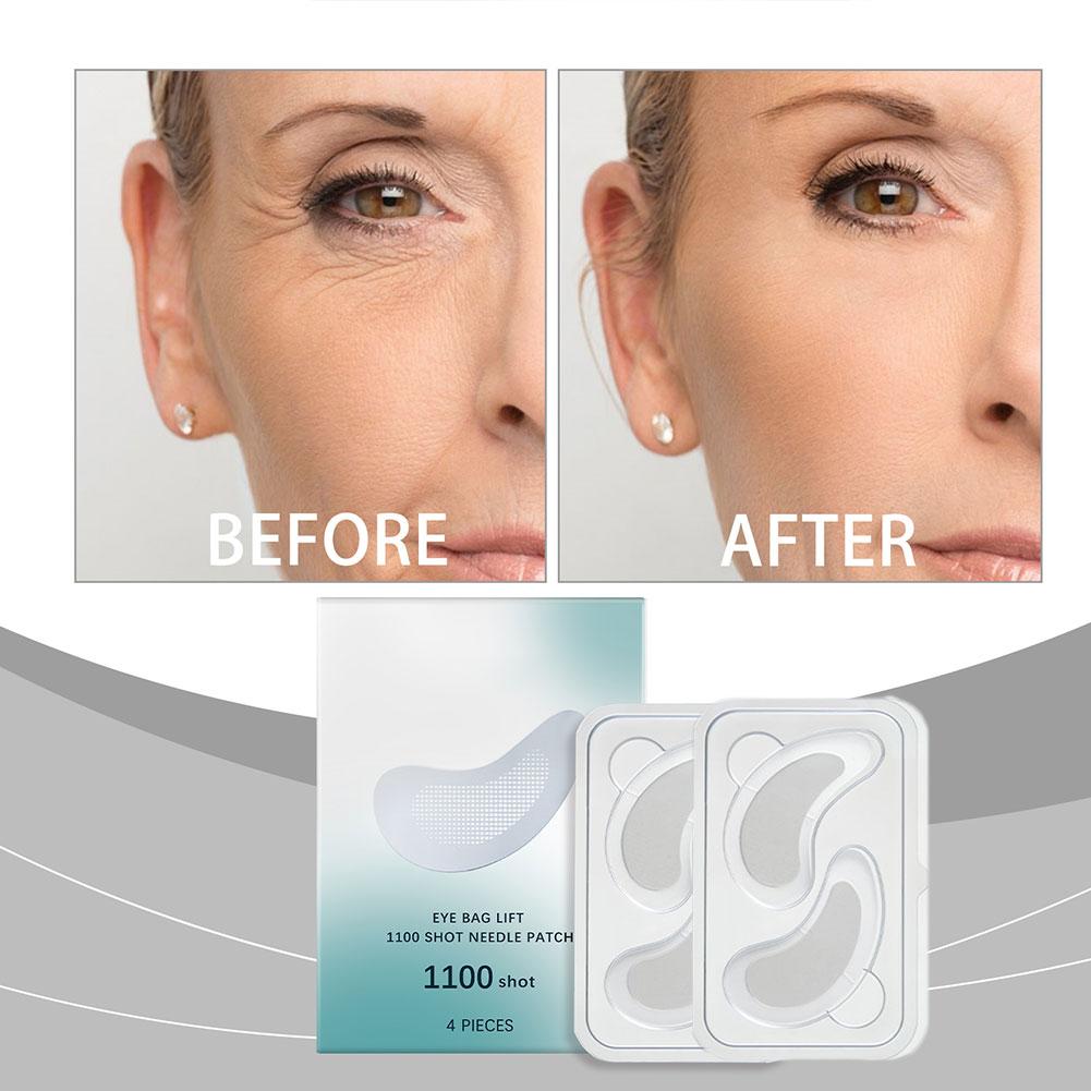 Гиалуроновая кислота, микроигл – обзор и цена Microneedle Patch Eye