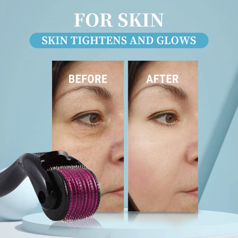 Профессиональный валик Derma 5 – обзор и цена Derma Roller 0.25